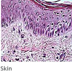 Regenerative Medicine: Skin tissue